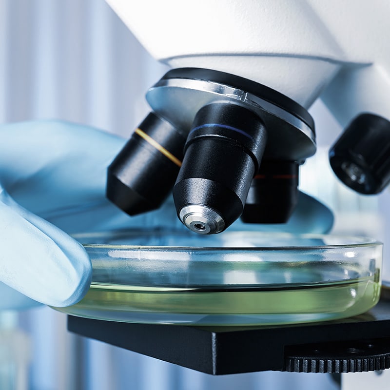 Om du har genomfört ett Mögel lufttest, men vill få vårt laboratorium att bedöma antal och arter åt dig, kan du nu köpa det som extra