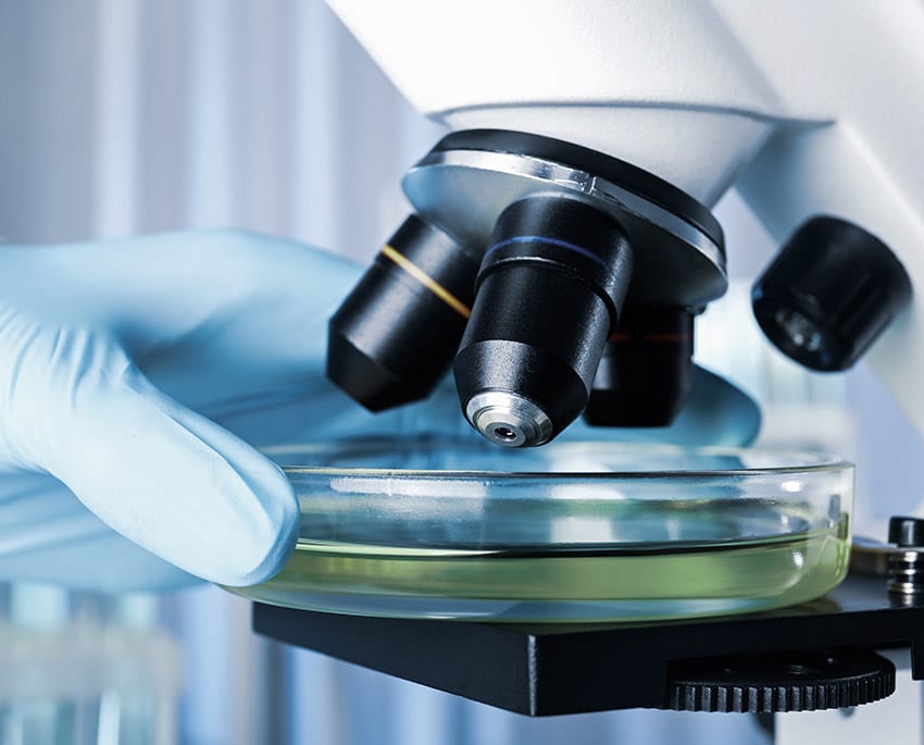 Det finns inga problem med att mäta efter mögel själv, att anlita en dyr firma för ett hembesök är inte nödvändigt. Det kan dock vara en bra idé att ta hjälp att analysera resultaten från ditt mögeltest