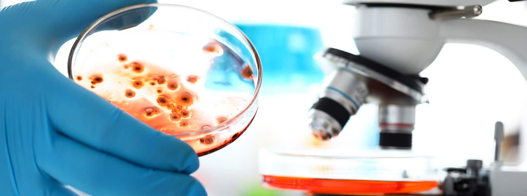 Vi har ett stort urval av mögeltester och vi kan därför leverera det optimala testet för alla jobb, oavsett om du handlar som privatkund eller som professionell rådgivare